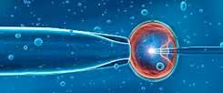 Ein Spermium wird in eine reife Eizelle gespritzt: Diese ICSI genannte Methode ist heute Standard in den rund 140 deutschen Kinderwunsch-Zentren (Foto: Jose Antonio Penas/Science Photo Library/Corbis)